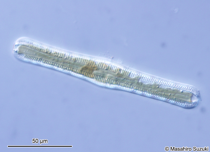 クシガタケイソウ属の1種 Rhopalodia ap.